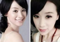 网友爆料疑似整容,疑似整容风波再起，明星形象面临考验